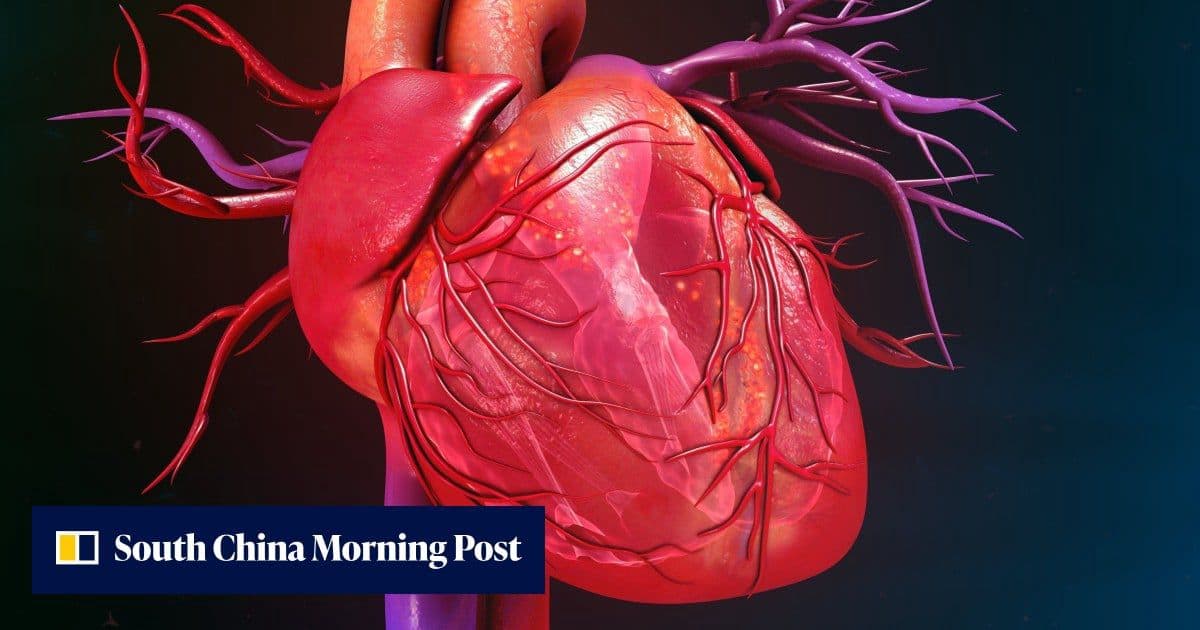 Chinese stem cell therapy restores heart function in 90% of trial patients